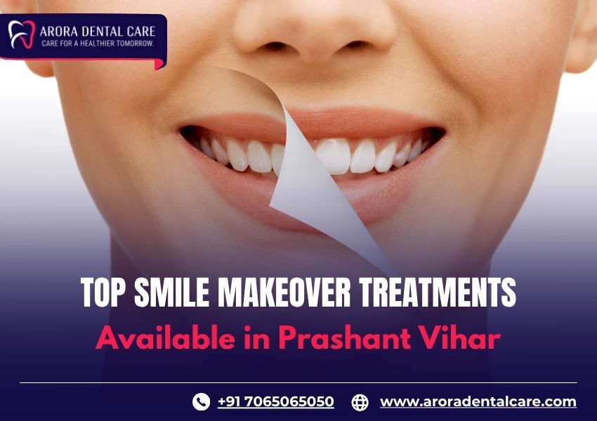 Top Smile Makeover Treatments Available in Prashant Vihar
